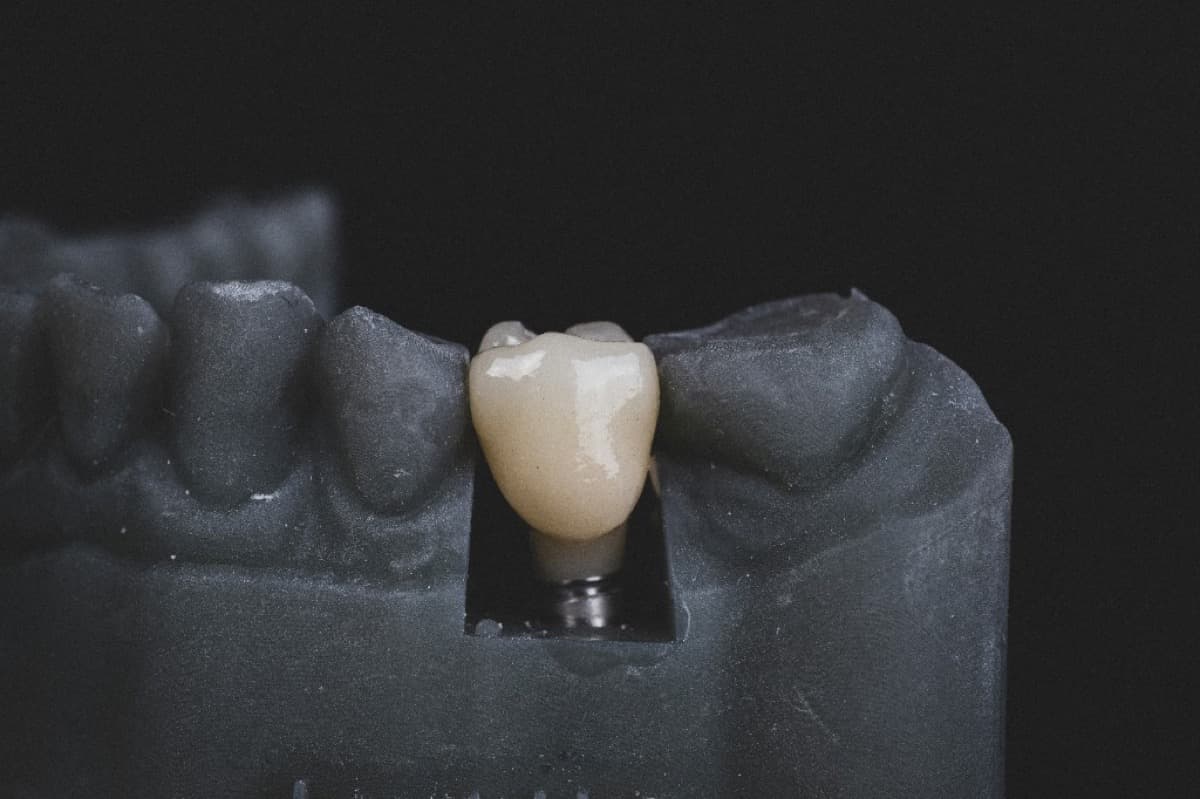 Restorative Dentistry