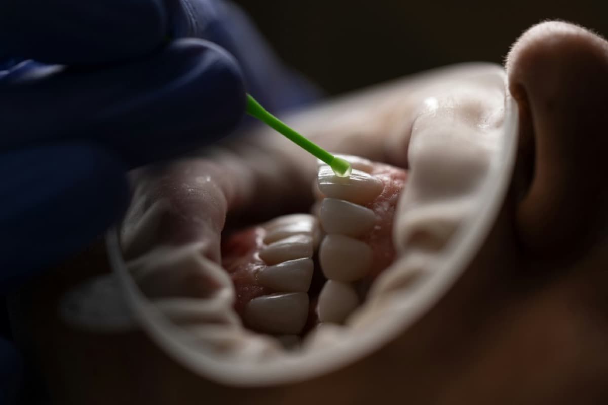 Esthetic Dentistry